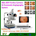 MSL-2ER 5 Step Magnification Ophthalmic Equipment low price slit lamp digital slit lamp microscope price